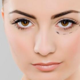 Blépharoplastie Tunisie : Chirurgie esthétique des paupières et cernes